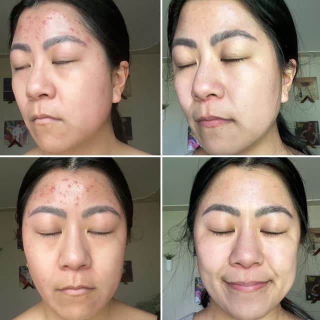 Spring Cleaning Advanced Peels at reBell Wellness in Grand rapids, MI